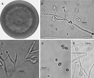Trichoderma spirale (Synanamorfo). a) colonia en medio de cultivo PDA, después de 14 días a 25°C, con abundante micelio aéreo; b) conidióforo; c) fiálides; d) conidios; e) clamidospora. Descripción: Chaverri, Castlebury, Overton y Samuels (2003); http://nt.arsgrin.gov/taxadescriptions/keys/TrichodermaIndex.cfm.