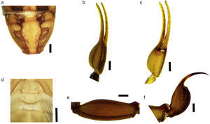 Sexual dimorphism in females Centruroides ruana sp. nov.: (a) tergite VII; (b) pedipalp chela dorsal view; (c) pedipalp chela ventral view; (d) basal pectinal plate; (e) metasomal segment V, lateral view; (f) telson, lateral view. Bars=1mm.