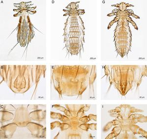 Fahrenholzia microcephala: (A) male, (B) genitalia, (C) thoracic sternal plate; Neohaematopinus neotomae: (D) female, (E) genitalia, (F) thoracic sternal plate; Polyplax auricularis: (G) male, (H) genitalia, (I) thoracic sternal plate.