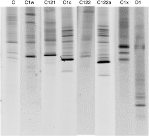 Perfil de los genotipos de dinoflagelados simbióticos diagnosticados por PCR-DGGE para la costa de Oaxaca. La letra mayúscula indica el clado, el número representa el tipo de ITS2 y la letra minúscula denota que existe un parálogo característico de ADN.