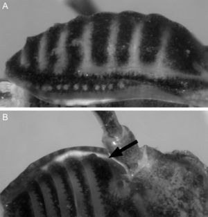 Philora mazateca sp. nov. Male holotype. A, dorsal ornamentation. B, setiferous tubercles on stigmatic area.