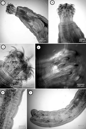 Female specimen of Pachysentis gethi. (a) Anterior region, lateral view; (b) anterior region, ventral view; (c) anterior end, detail of proboscis, lateral view; (d) anterior end, detail of hooks and roots of hooks, ventral view; (e) details of the location of eggs, lateral view; (f) posterior region, detail of apical genital pore, lateral view.