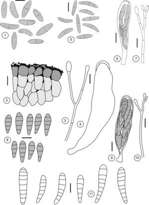 1-4: Dactylospora stygia var. stygia, 1: ascosporas, 2: excípulo ectal, 3: paráfisis, 4: asca vacía. 5-7: D. stygia var. tenuispora, 5: ascosporas, 6: asca con ascosporas, 7: paráfisis. 8-10: Hysteropatella clavispora, 8: ascosporas, 9: asca con ascosporas, 10: paráfisis. 11: ascosporas de Patellaria atrata. Barra:=10μm, excepto en las figuras 3 y 4, en donde equivale a 5μm.