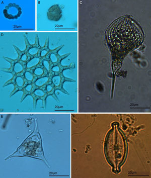 Organismos representativos de cada grupo taxonómico del fitoplancton encontrado en el sistema lagunar Chaschoc. A) Cyanophyta: Dolichospermum spiroides (Klebhan) Wacklin, L. Hoffmann et Komárek; B) Dinophyta: Peridinium sp.; C) Euglenophyta: Phacus tortus (Lemmermann) Skvortzov; D) Chlorophyta: Monactinus simplex (Meyen) Corda; E) Cryptophyta: Tetraëdriella regularis (Kützing) Fott; F) Bacillariophyta: Placoneis gastrum (Ehrenberg) Kützing.