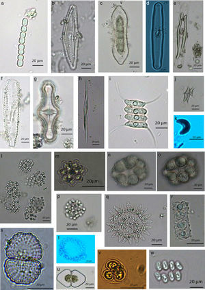 Nuevos registros para la cuenca baja del río Usumacinta. (+) Especies indicadoras de eutrofización. a) Komvophoron schmidlei (Jaag) Anagnostidis et Komárek; b) +Cymbella cymbiformis C. Agardh; c) +Fragilaria constricta Ehrenberg; d) +Pinnularia macilenta Ehrenberg; e) +Pinnularia nobilis (Ehrenberg) Ehrenberg; f) +Surirella elegans Ehrenberg; g) Tabellaria flocculosa (Roth) Kützing; h) +Ankistrodesmus longissimus (Lemmermann) Wille; i) Desmodesmus tropicus (W. B. Crow) E. Hegewald; j) +Dicloster acuatus C.-C. Jao, Y. S. Wei et H. C. Hu; k) Kirchneriella aperta Teiling; l) Aphanocapsa koordersii K. M. StrØm; m) Coelastrum verrucosum (Reinsch) Reinsch; n) y o) Hariotina reticulata P. A. Dangeard; p) Snowella lacustris (Chodat) Komárek et Hindák; q) Pediastrum duplex var. subgranulatum Raciborski; r) Euastrum biverrucosum A. A. Gontcharov et M. M. Watanabe; s) Cosmarium vexatum West; t) Aphanocapsa annulata G. B. McGregor; u) Cosmarium granatum Brébisson ex Falfs; v) Gloeocystis major Gerneck ex Lemmermann; w) Comasiella arcuata (Lemmermann) E. Hegewald, M. Wolf, Al. Keller, Friedl et Krienitz.