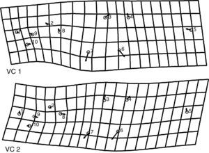 Mallas de deformación con vectores de los primeros 2 ejes del análisis de variantes canónicas. Se resalta el cambio de la figura con mayor influencia en la separación de los ejemplares de cada localidad.