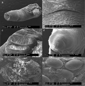 SEM images of Multicalyx cristata: (a) anterior view showing the mouth funnel, genital pore, and anterior alveoli; (b) genital pore; (c) alveoli; (d) excretory papilla; (e) uterus and eggs; and (f) embryonated eggs.