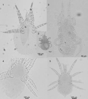 1, Ornithonyssus bursa. Female. 2, Ornithonyssus bursa. Female with an egg inside. 3, Ornithonyssus bursa. Male. 4, Ornithonyssus bursa. Protonymph, dorsal view. 5, Ornithonyssus bursa. Protonymph, ventral view.
