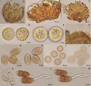 A-E, Canasta amphilophii (sobre Amphilophium paniculatum): A-C, uredosoros; A, uredosporas y paráfisis; B, vista lateral paráfisis con ápice mucronado; C, vista inferior, base en forma de disco; D-E, uredosporas; D, vista media; E, vista superficial; F-M, Prospodium aculeatum (sobre Tecoma stans): F, espermogonio; G-J eciosporas uredinoides; G, eciosporas elipsoides en vista media; H, eciosporas elipsoides en vista superficial; I, eciosporas globosas en vista media; J, eciosporas globosas en vista superficial; K, paráfisis; L-M, teliosporas; L, vista media; M, vista superficial.