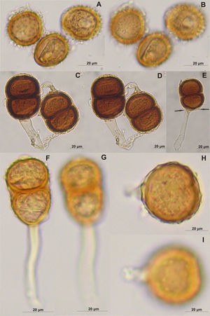 A-E, Prospodium delostomae (sobre Delostoma integrifolium): A-B, uredosporas; A, vista media; B, vista superficial; C-E, teliosporas; C, vista media; D, vista superficial; E, pedicelo lateral y poros (flecha); F-I, Prospodium trinidadense (sobre Bignoniaceae indet.): F-G, teliosporas bicelulares; F, vista media; G, vista superficial; H-I, mesospora; H, vista media; I, vista superficial.
