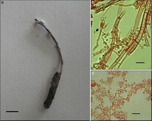 Ophiocordyceps stylophora: a)sinema emergiendo del tórax de una larva de coleóptero; b)fiálides con conidios, y c)conidios. Escalas: 1cm (a) y 10μm (b y c).
