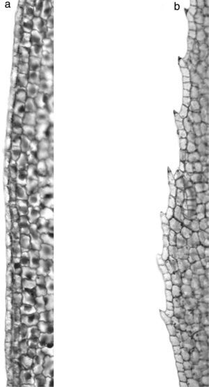 Detalle del borde de la hoja: a) entero (material recolectado), b) serrado (Halophila decipiens).