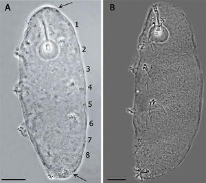 (A) Juvenile in the first stage of life, showing the pattern of 8 bands of pores on its cuticle (scale bar 20μm). Arrows indicate the cluster of pores in the cephalic (anterior to the row 1) and caudal region (posterior to the row 8). (B) Specimen in third life stage showing the pores scattered on the cuticle.