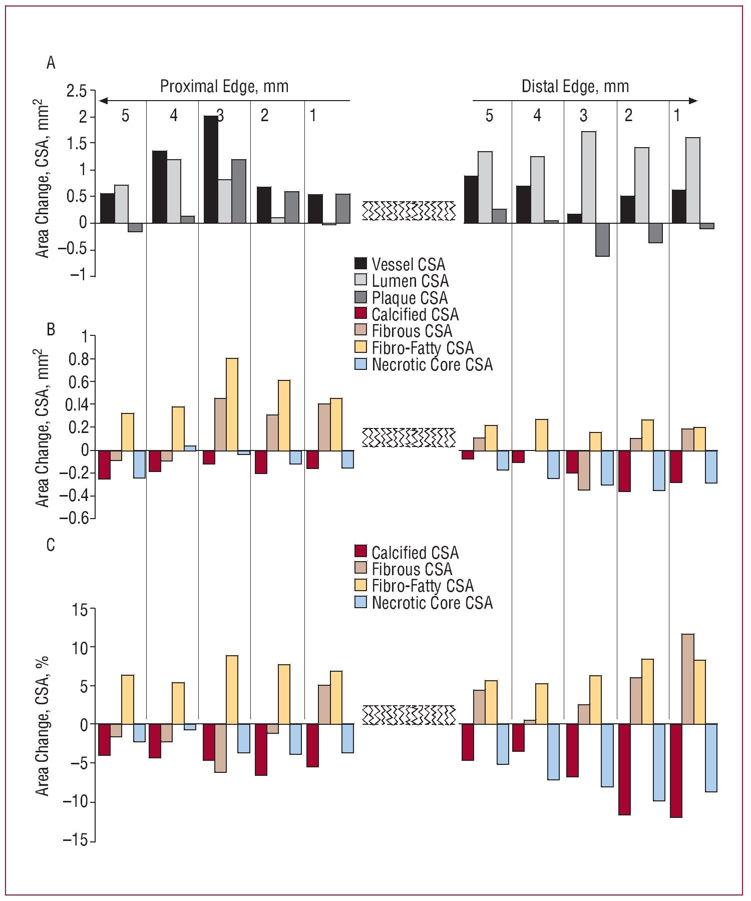 Characterization Of Edge Effects With Paclitaxel-Eluting Stents Using ...