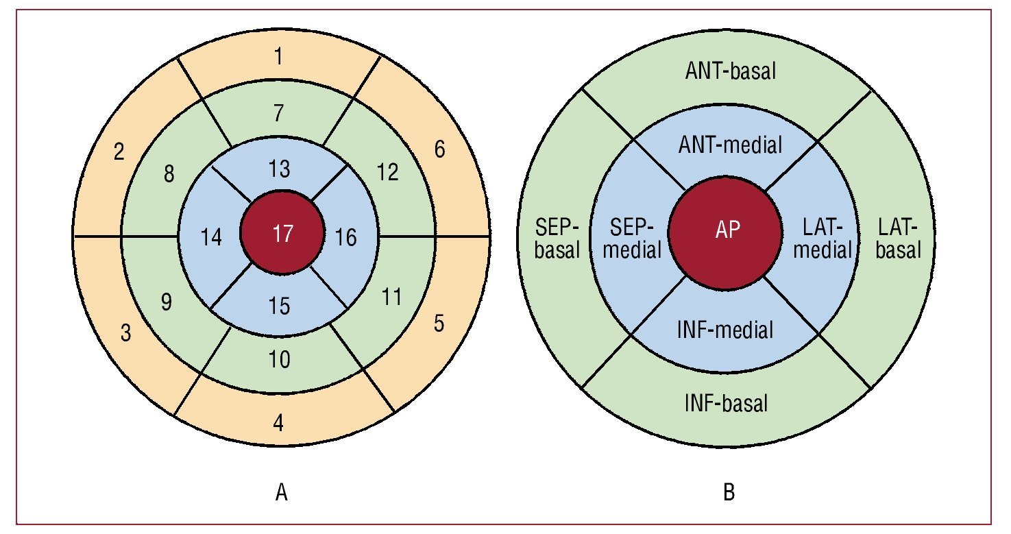 Spect Segment Normal Myocardial Perfusion SPECT Database for the Spanish Population ...