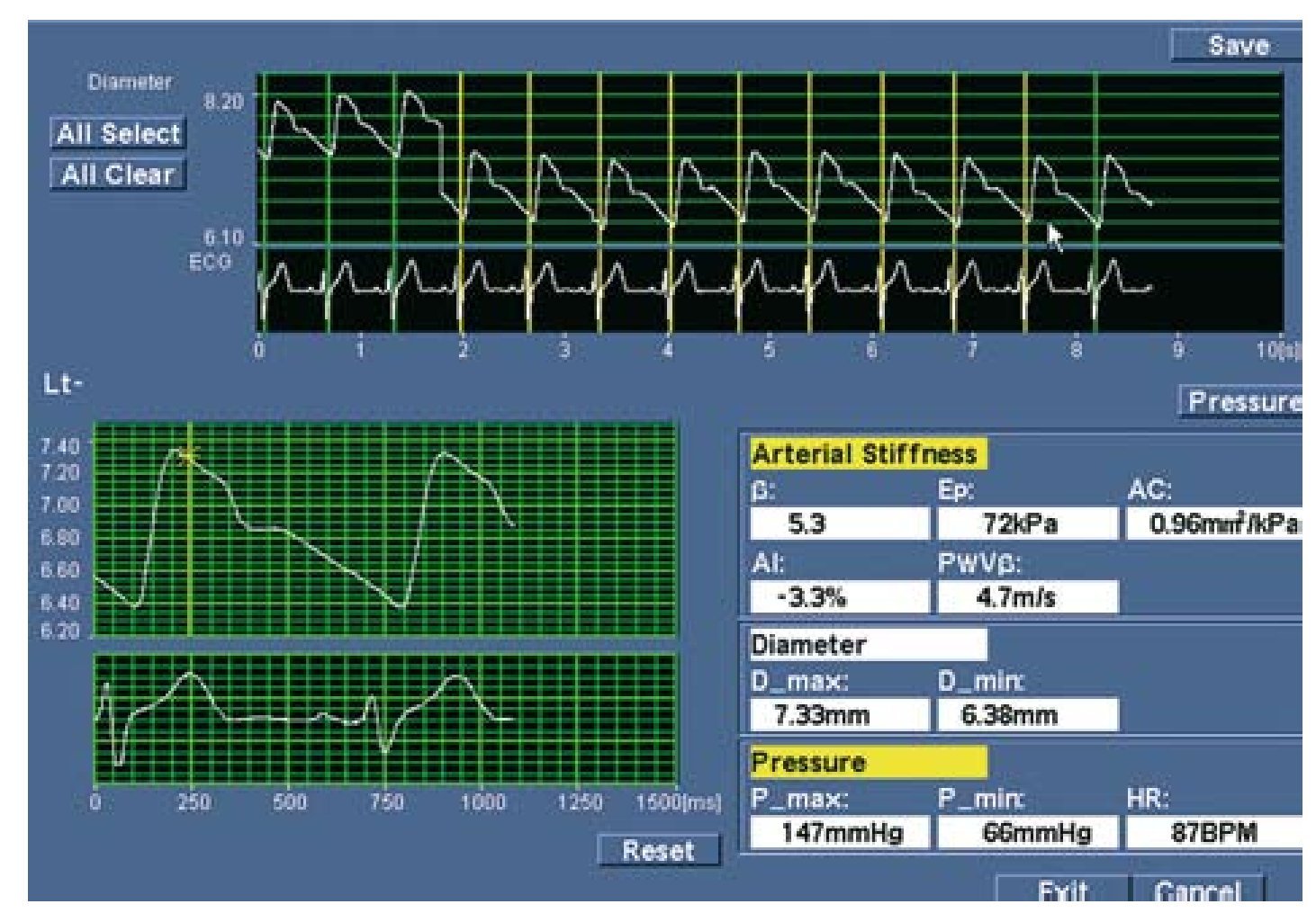 Blood pressure measurement in children and adolescents: key element in the  evaluation of arterial hypertension - ScienceDirect