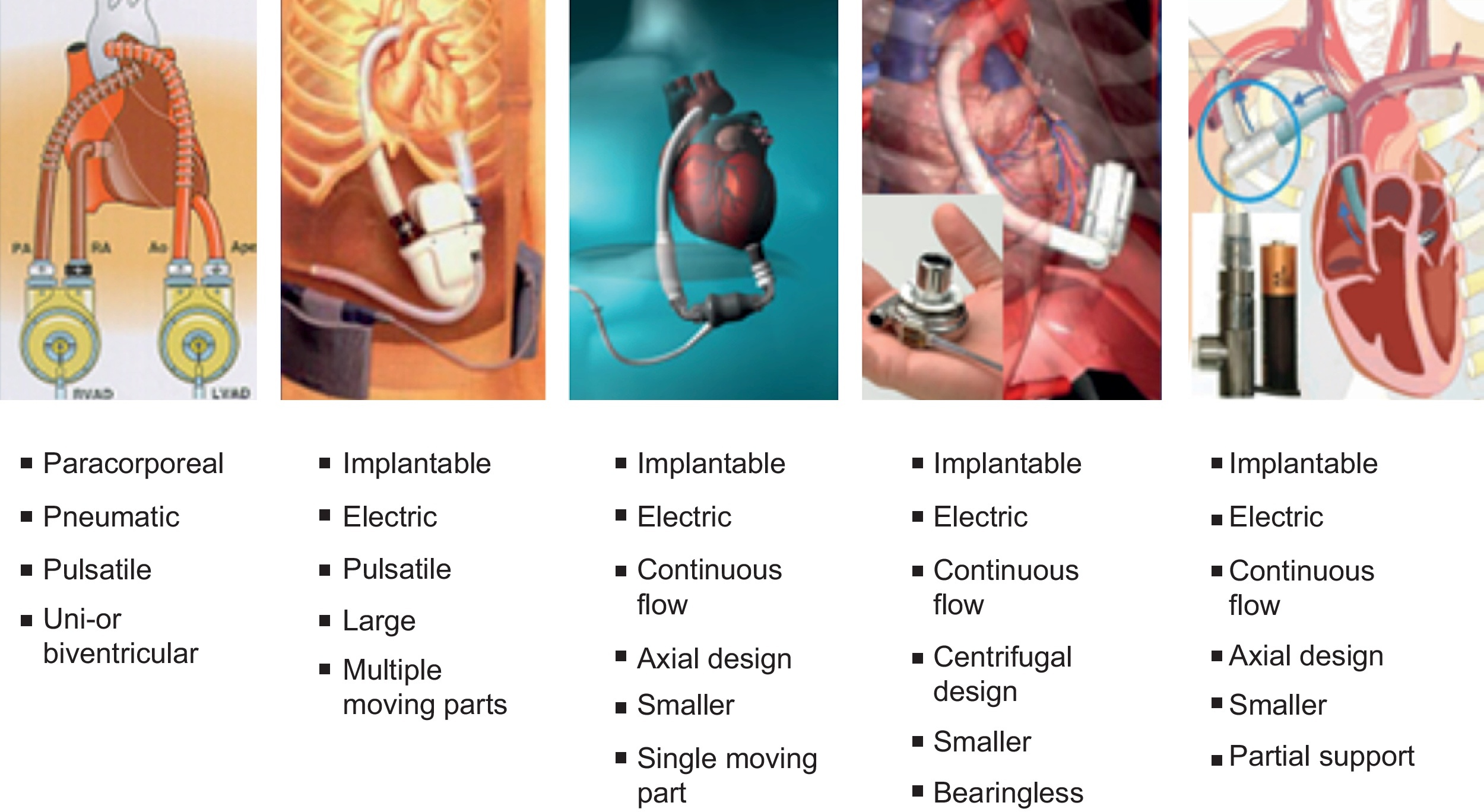 The Role of Ventricular Assist Devices in Advanced Heart Failure ...