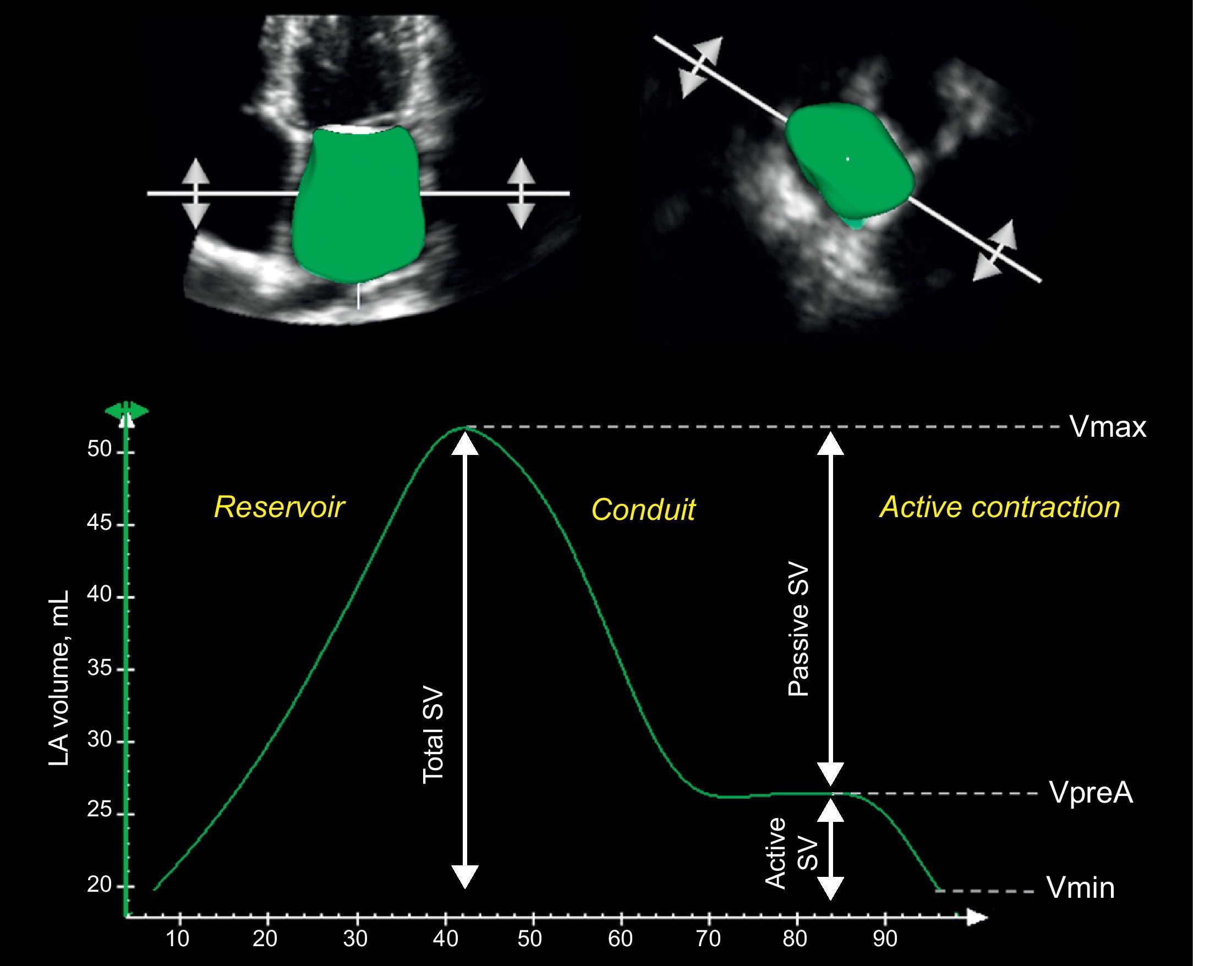 Left Atrium Volume Graph Left Atrium as a Dynamic Three-Dimensional Entity: Implications for ...