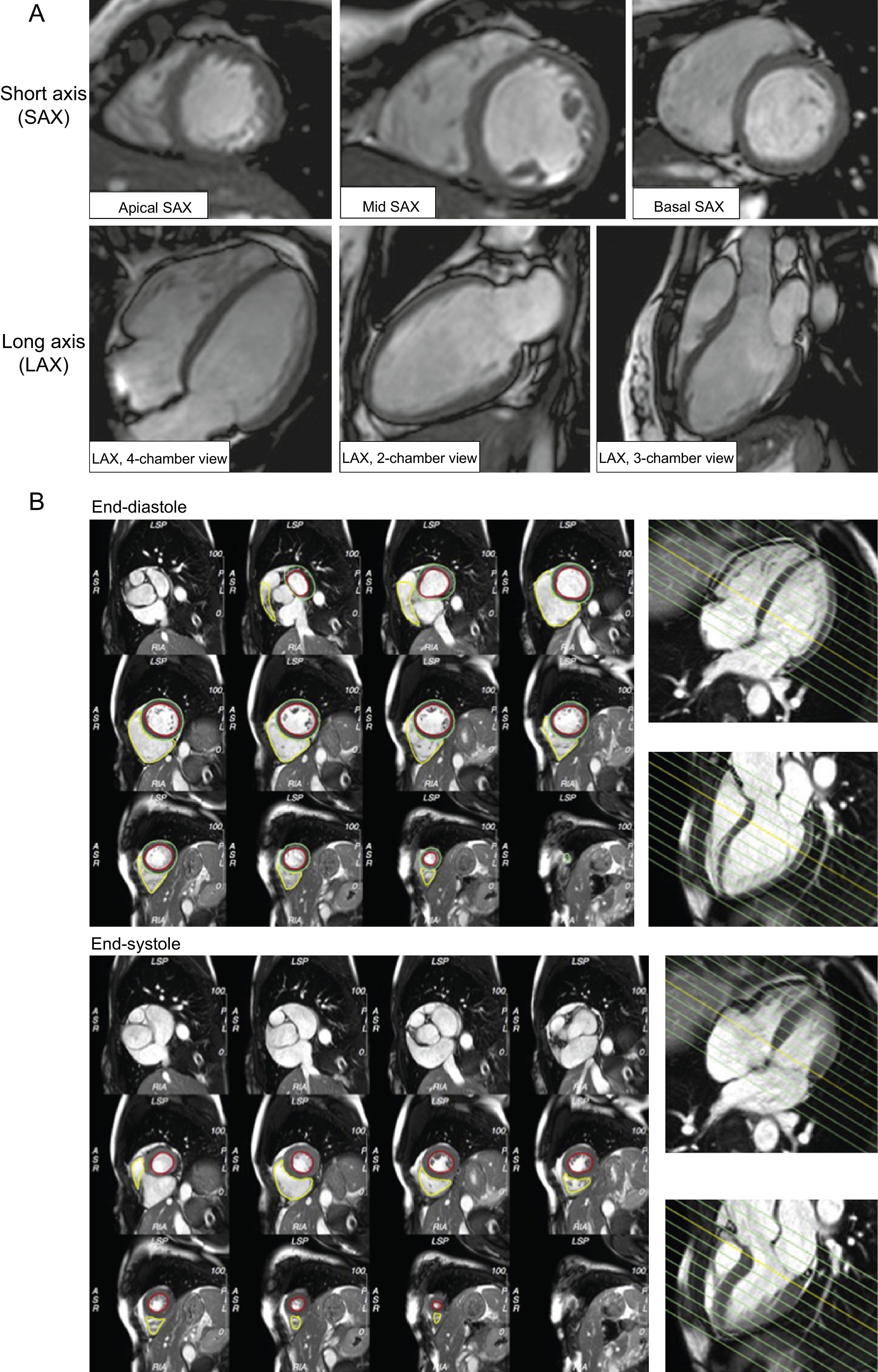 洋書 Cardiovascular Magnetic Resonance, 2e Cardiovascular 洋書 Cardiovascular Magnetic Resonance, 2e Cardiovascular