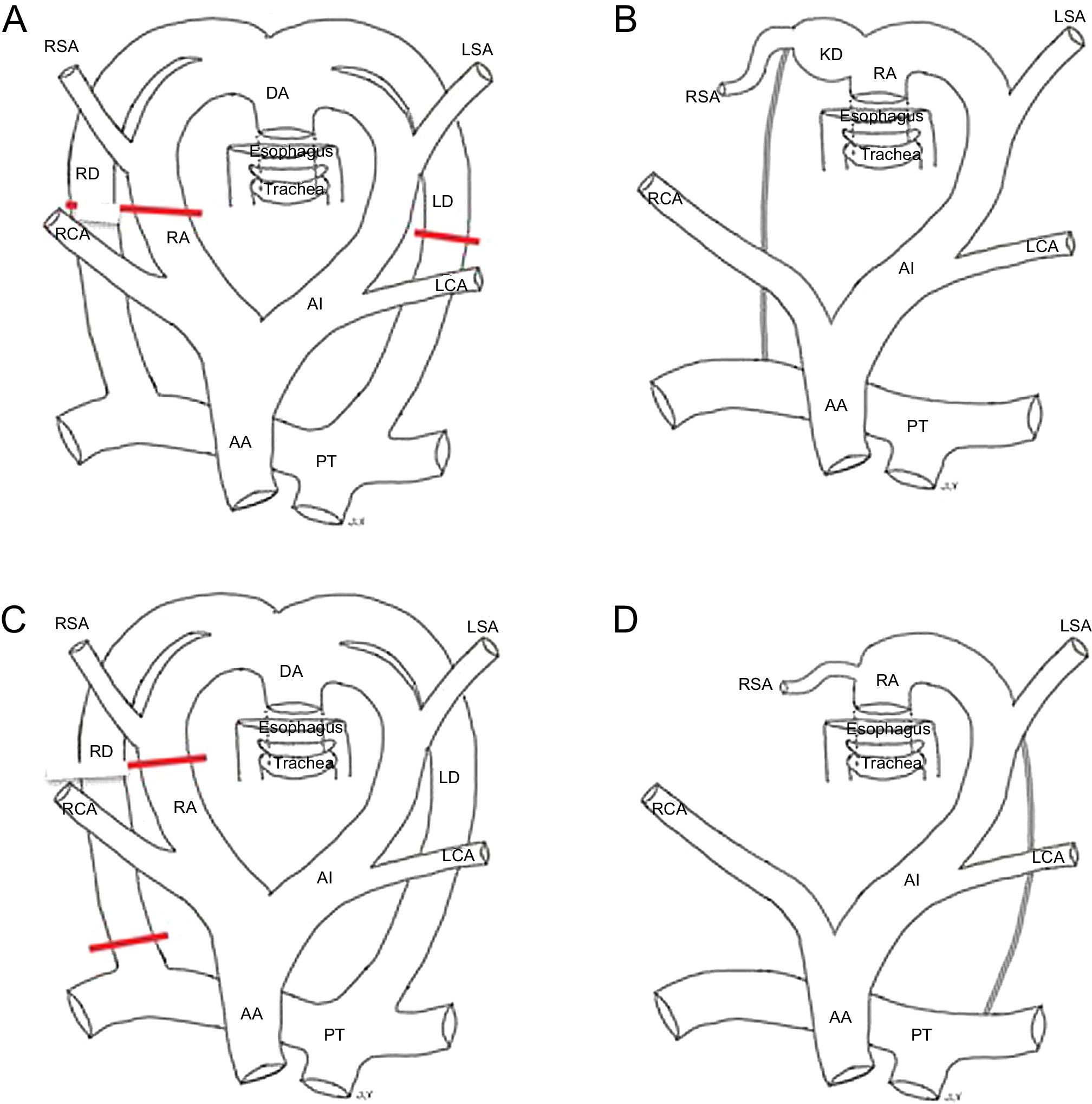 Multidetector Computed Tomography for Congenital Anomalies of the ...