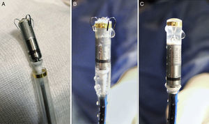 Micra pacemaker and deployment system. A: view of the device after it is removed from the sterile package. B: view of the device as it is flushed with saline solution before complete retraction into the device cup (also how it will look at initiation of deployment). C: the device is completely retracted into the device cup, and is adequately perfused with heparinized saline solution before the delivery system is inserted in the introducer sheath.