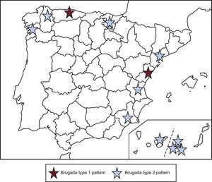 Geographic distribution of the Brugada-type the electrocardiographic patterns found.