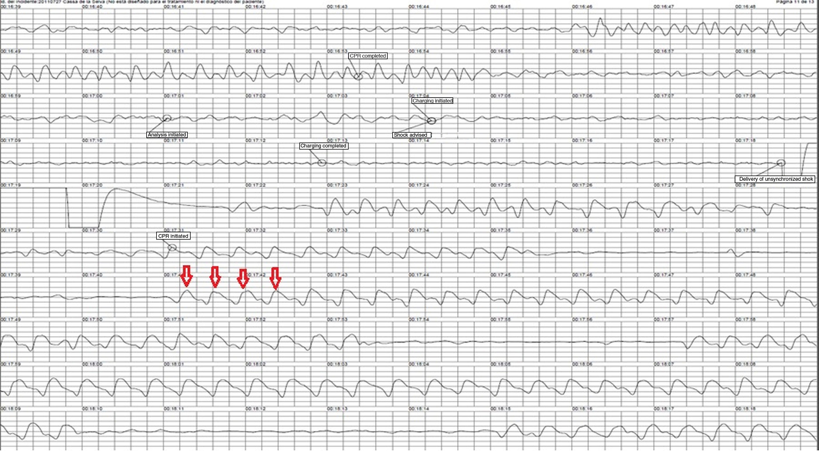 The Girona Territori Cardioprotegit Project: Performance Evaluation of ...
