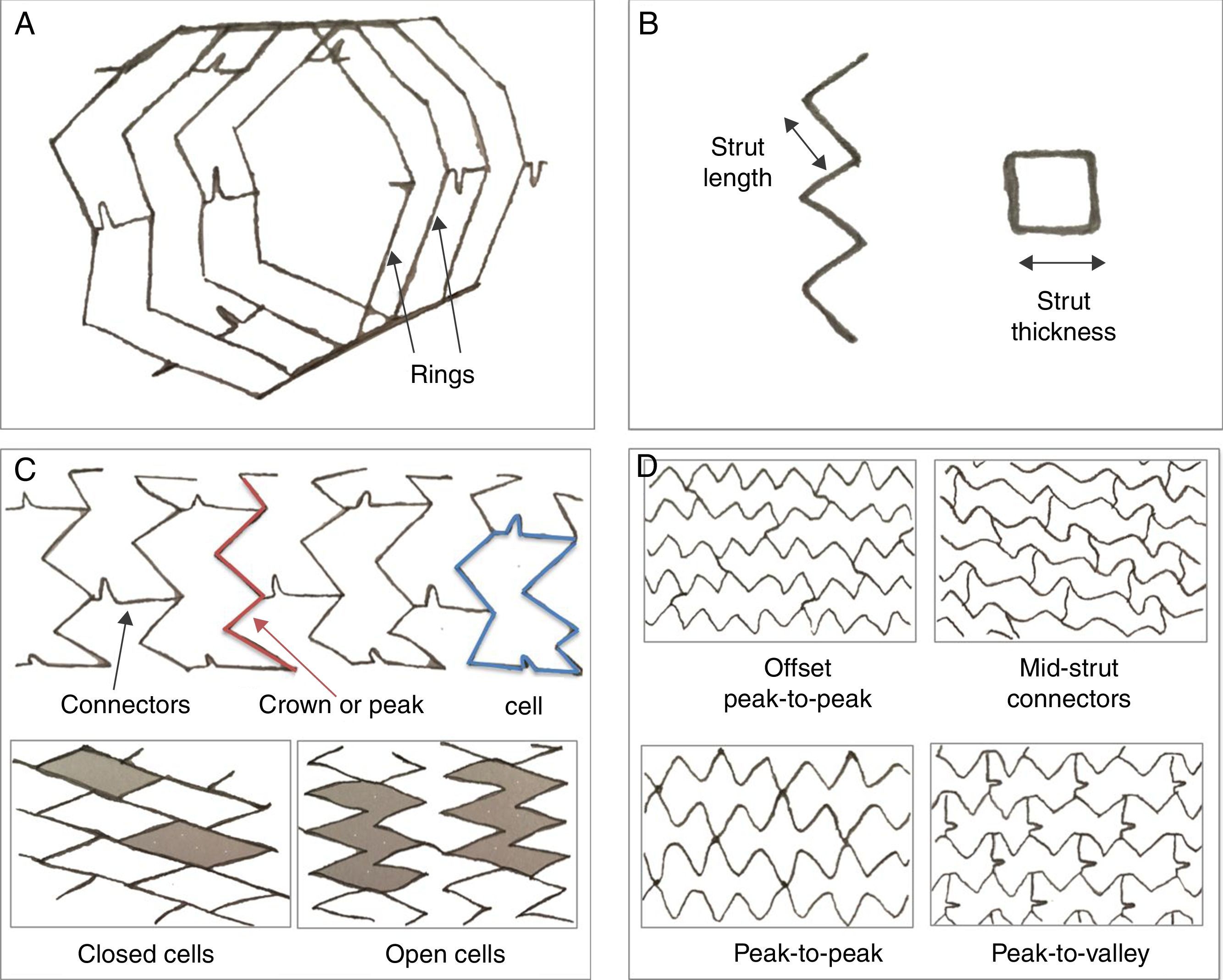 A Brief History of Coronary Artery Stents - Revista Española de ...