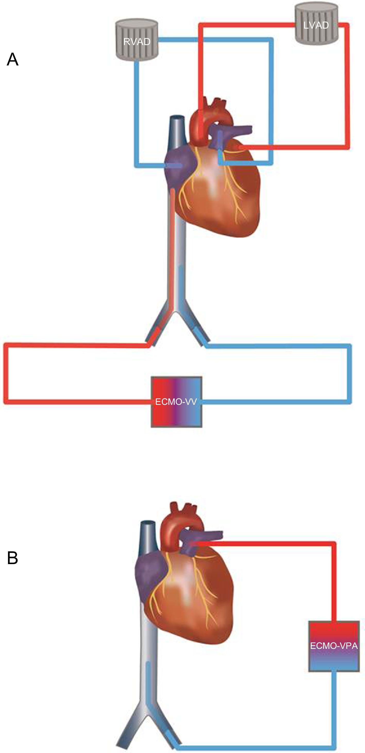 Severe Combined Right Ventricular and Respiratory Failure. Treatment ...