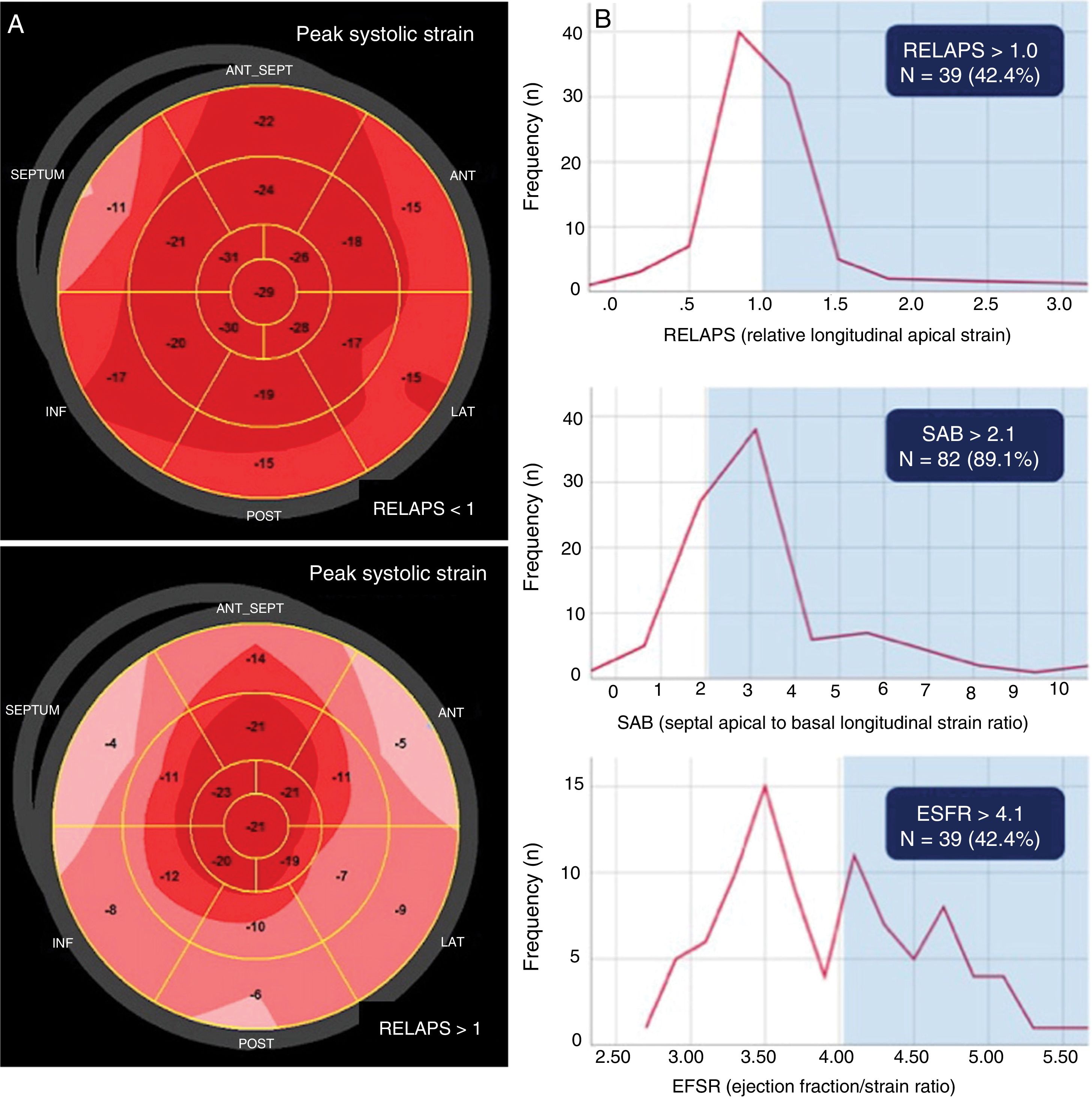 Left ventricle myocardial deformation pattern in severe aortic valve ...
