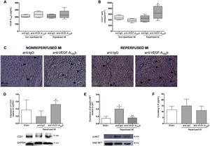 Vascular endothelial growth factor (VEGF)-A165b blockade increased capillary density in animals undergoing reperfused, but not in nonreperfused, myocardial infarction (MI). A: serum VEGF-A165b levels prior to sacrifice were similar in all 4 experimental groups. B: quantification of CD31+ vessels. Five independent images from the infarcted area isolated from the 4 independent MI groups were taken and then analyzed by a blinded observer unaware of the experimental group. C: representative images from infarcted tissue isolated the 4 experimental groups stained with the specific vascular marker CD31. D: western blotting analysis of CD31 protein expression in myocardial tissue isolated from sham and both reperfused MI groups treated with anti-IgG or anti-VEGF-A165b blocking antibody. E: western blotting analysis of phospho AKT/total AKT in the infarct tissue isolated from sham and both reperfused MI groups treated with anti-IgG or anti-VEGF-A165b blocking antibody. F: circulating interleukin (IL)-6 levels from both reperfused MI groups treated with anti-IgG or anti-VEGF-A165b blocking antibody. Continuous normally distributed data (n=13 animals per group) are expressed as mean±standard deviation and were analyzed by the unpaired Student t test. *P <.05 vs sham. +P <.05; ++P <.01 vs animals undergoing reperfused MI treated with anti-IgG antibody.