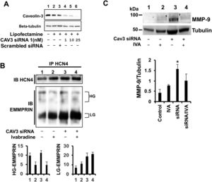 Lack of caveolin-3 impairs formation of the EMMPRIN/HCN4 complex. A: immunoblotting of caveolin-3 from H9c2 cells transfected with Lipofectamine (no siRNA) or 1, 10, and 25nM caveolin-3 siRNA1. Beta-tubulin was used as a negative control. B, upper panel: immunoblotting of HCN4 from extracts immunoprecipitated with HCN4 from H9c2 cells silenced with 10nM caveolin-3 siRNA1; lower panel: immunoblotting of EMMPRIN from the same extracts (N=3). C: immunoblotting of MMP-9 in H9c2-silenced cells incubated with 0.3mg/kg ivabradine (N=3, mean±standard deviation; P <.001 for siRNA vs siRNA + ivabradine). MMP-9, matrix metalloproteinase-9; siRNA, small interfering RNA.