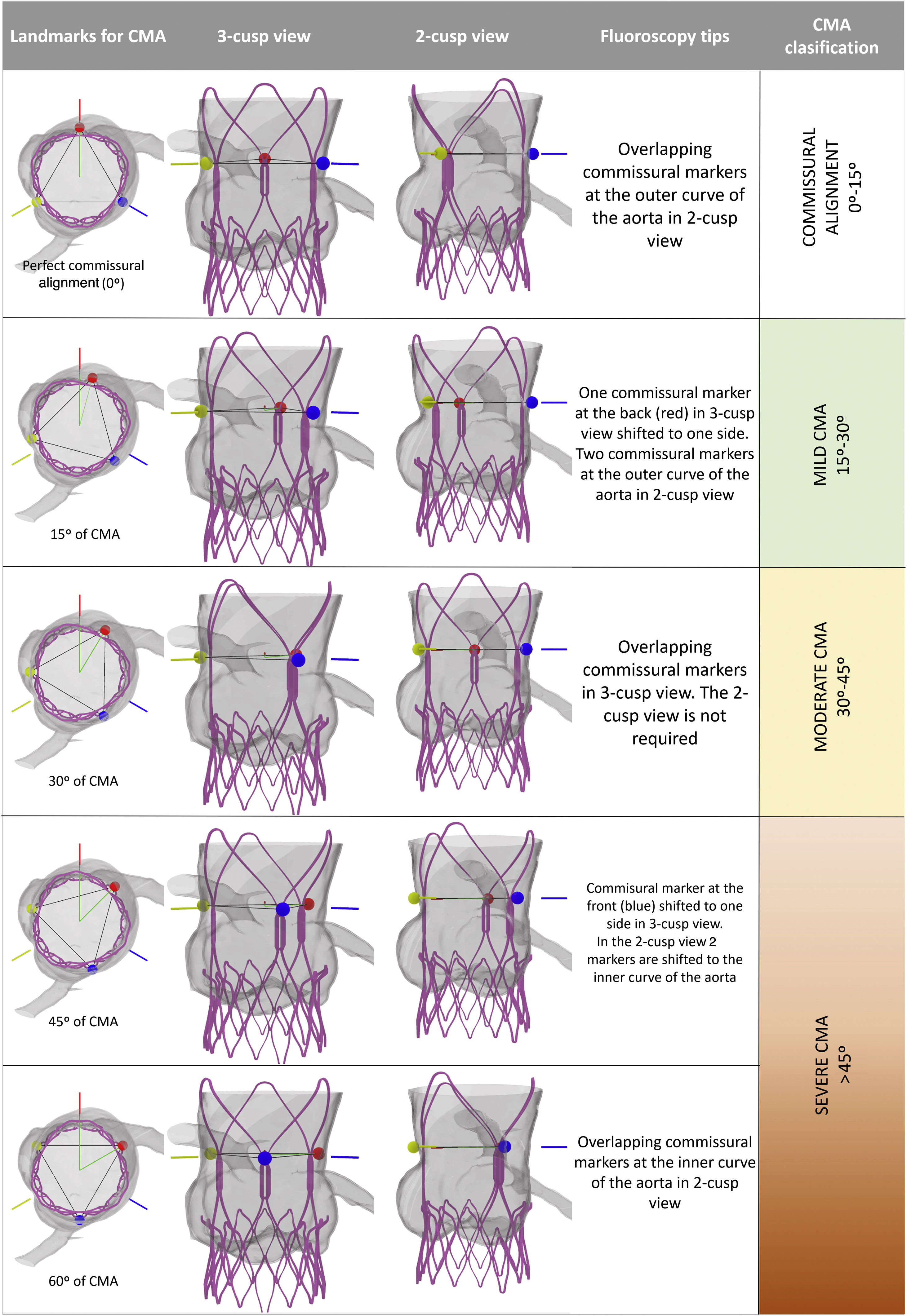 Fluoroscopic-based algorithm for commissural alignment assessment after ...