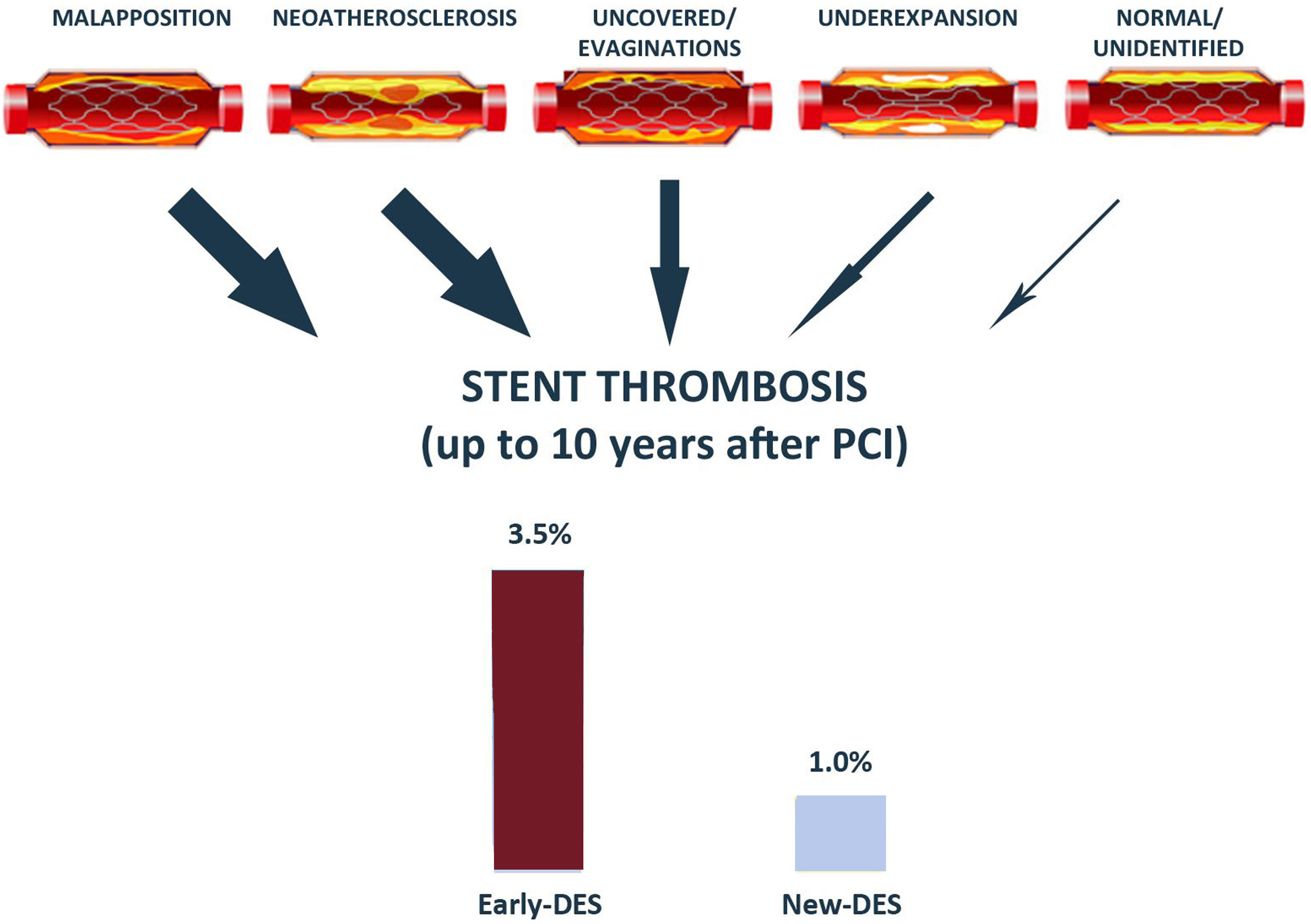 What Happens To Stent After 10 Years