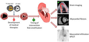 Central illustration. Multimodality imaging in aortic stenosis. In the evaluation of the effect of therapies targeting the pathophysiology underlying the progression of calcific aortic stenosis, imaging techniques such as 18F-NaF positron emission tomography or computed tomography can detect structural changes of the valve earlier than the hemodynamic consequences of the stenosis. Once severe aortic stenosis is diagnosed, markers other than symptoms and left ventricular ejection fraction can help to risk stratify patients who may benefit from early intervention. These markers include myocardial strain imaging, myocardial fibrosis on cardiovascular magnetic resonance and, in some patients, the presence of transthyretin cardiac amyloidosis can be ruled out with the use of technetium 99m pyrophosphate scintigraphy. AVC, aortic valve calcium; CT, computed tomography; F, fluor; NaF, sodium fluorine; PET, positron emission tomography; SPECT, single photon emission computed tomography.