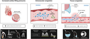 Central illustration. Multiparametric and integrative approach to congestion diagnostics.