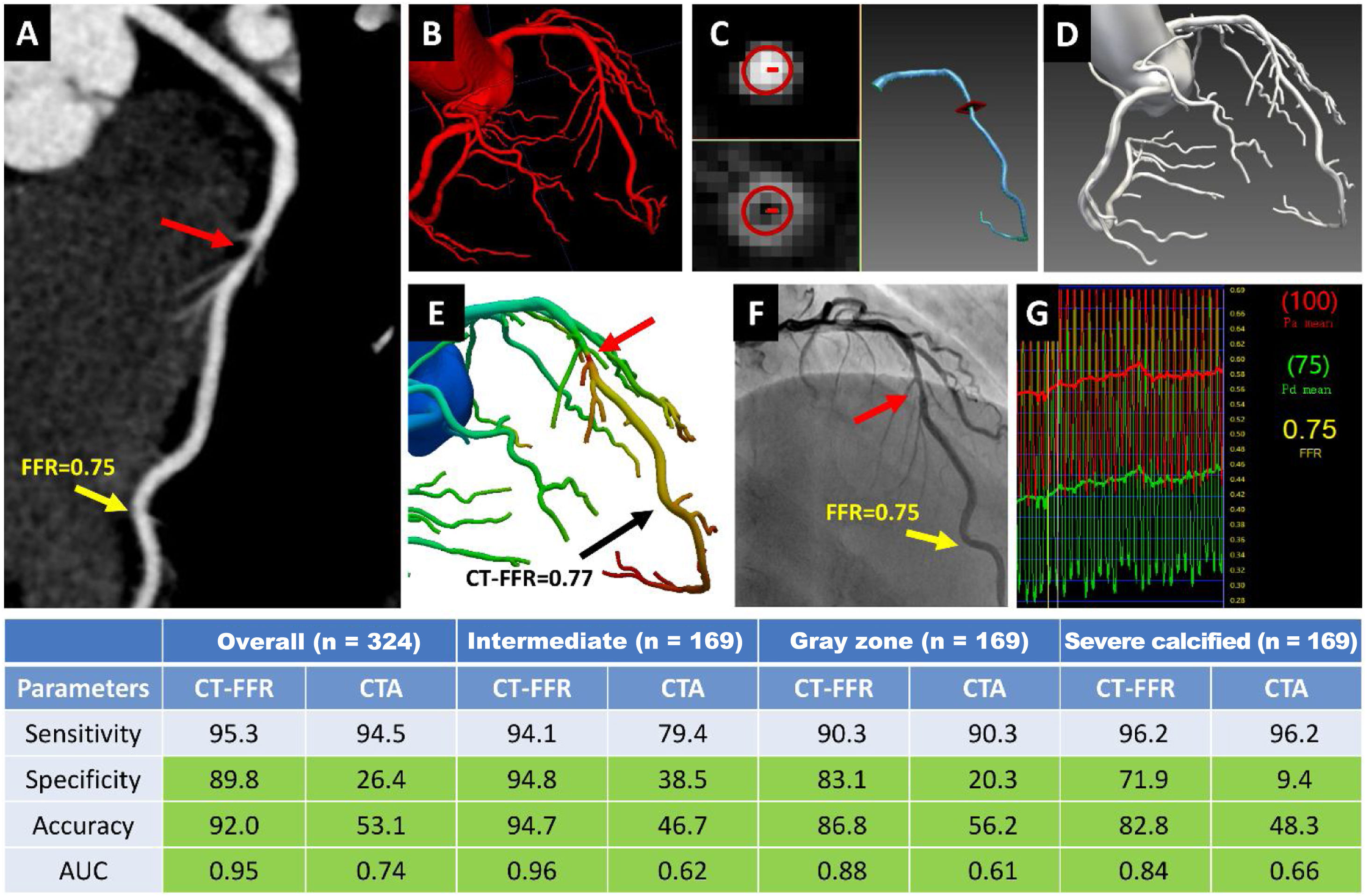 Diagnostic accuracy of CT-FFR with a new coarse-to-fine subpixel ...