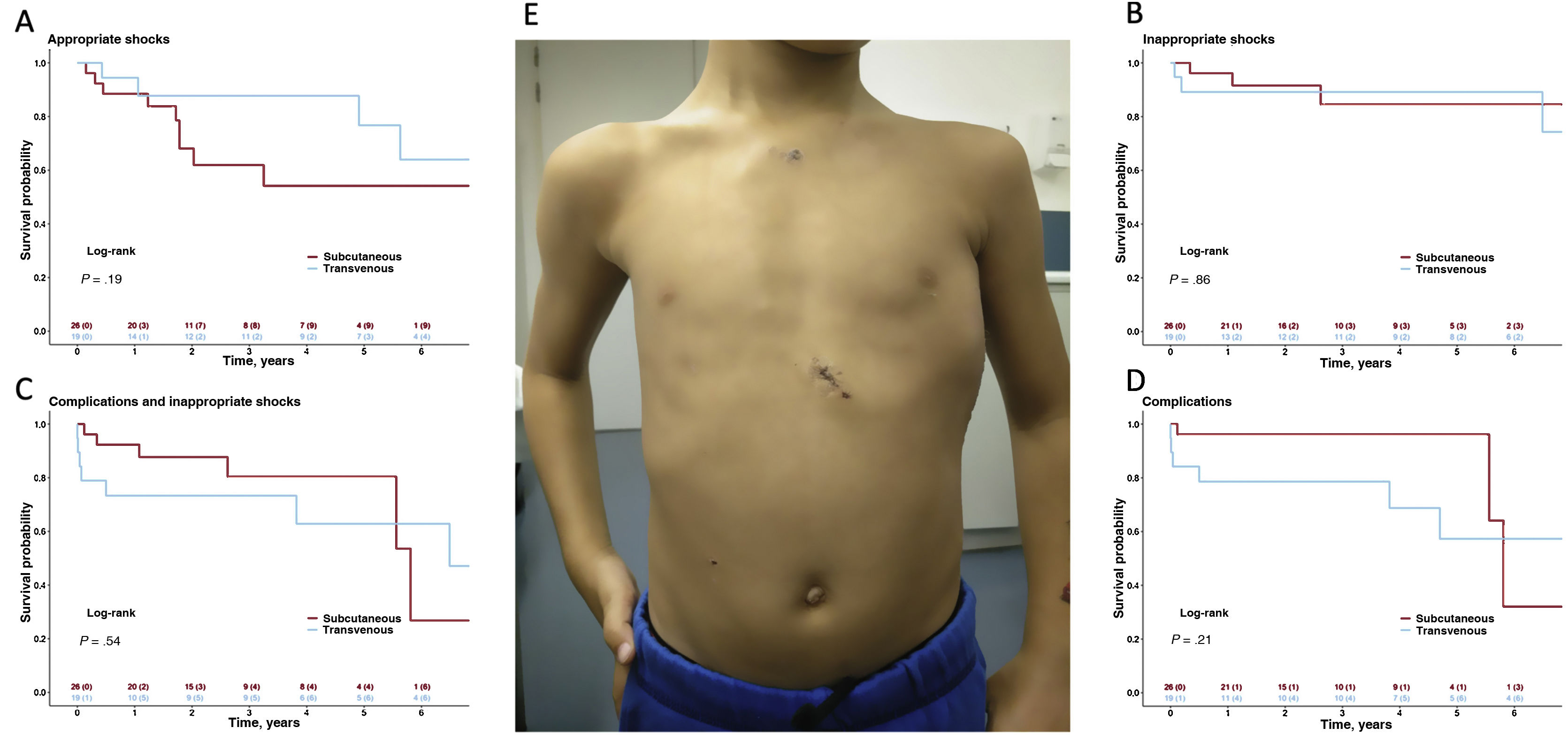 Complications and inappropriate shocks in pediatric patients receiving ...