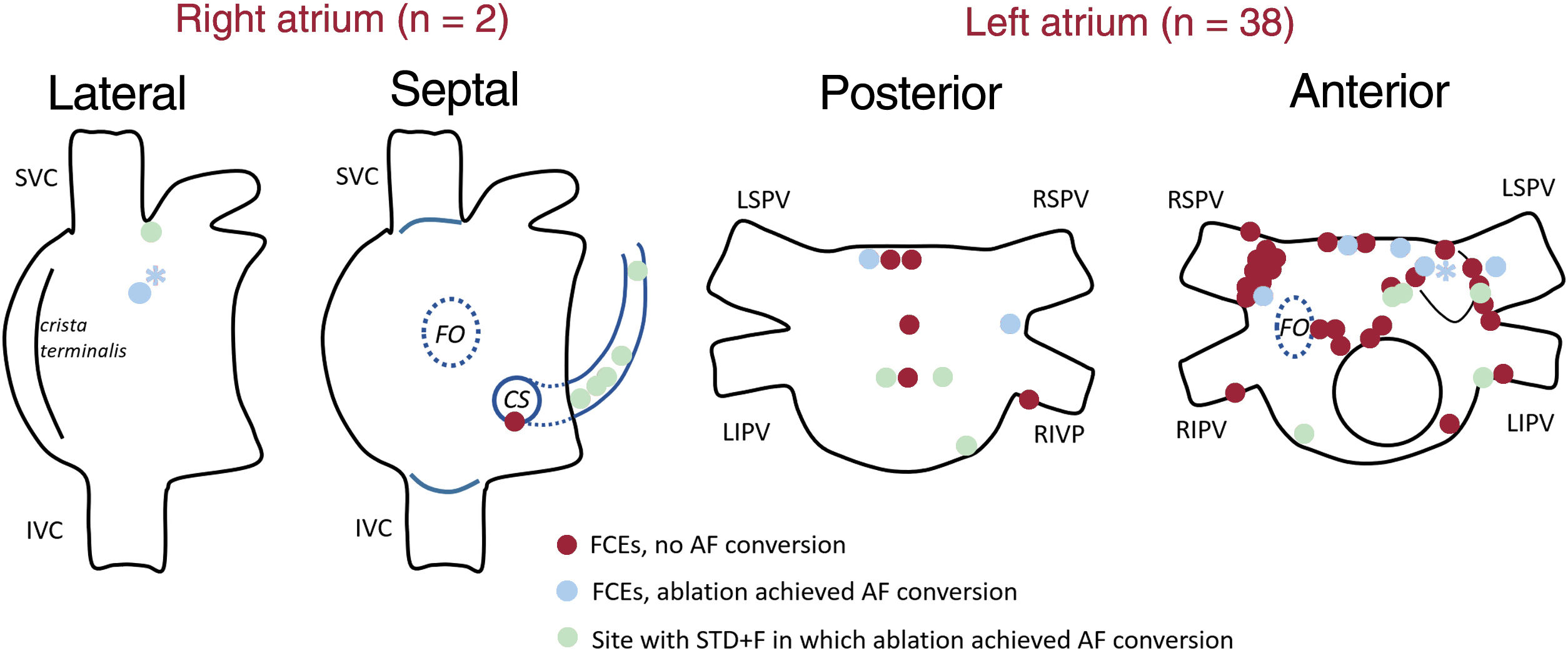 Subjective identification and ablation of drivers improves rhythm ...