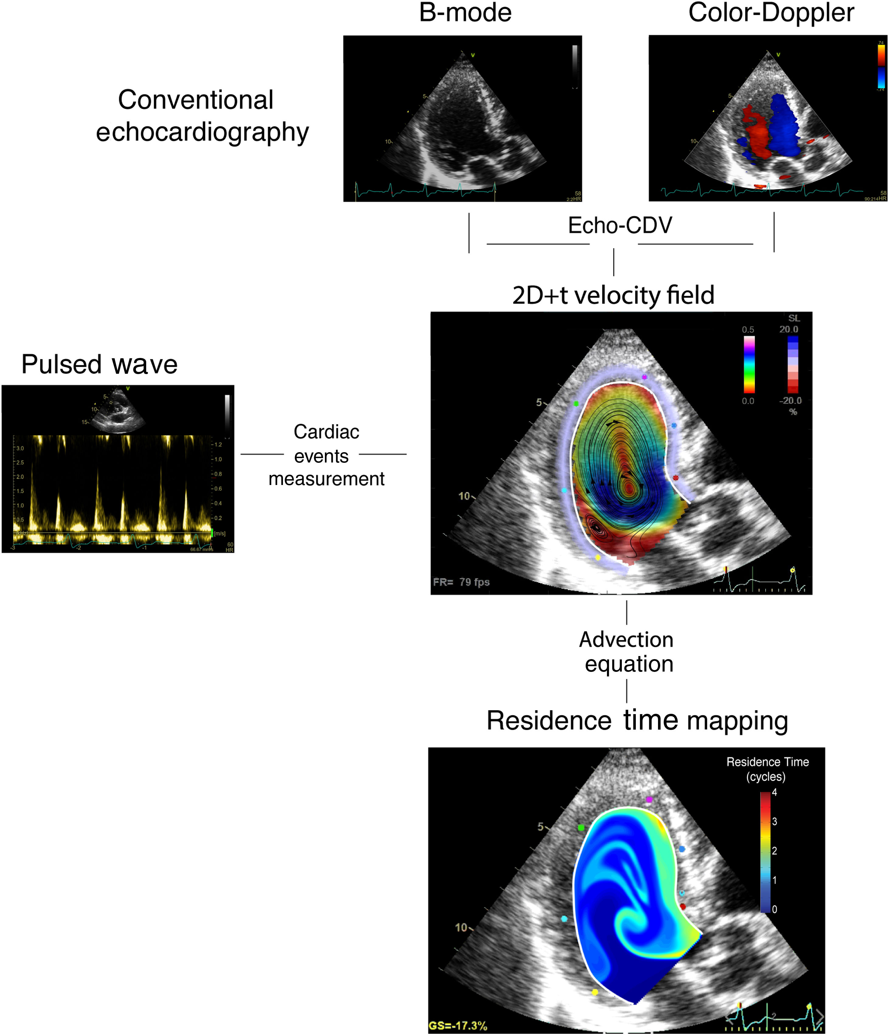 Stasis imaging predicts the risk of cardioembolic events related to ...