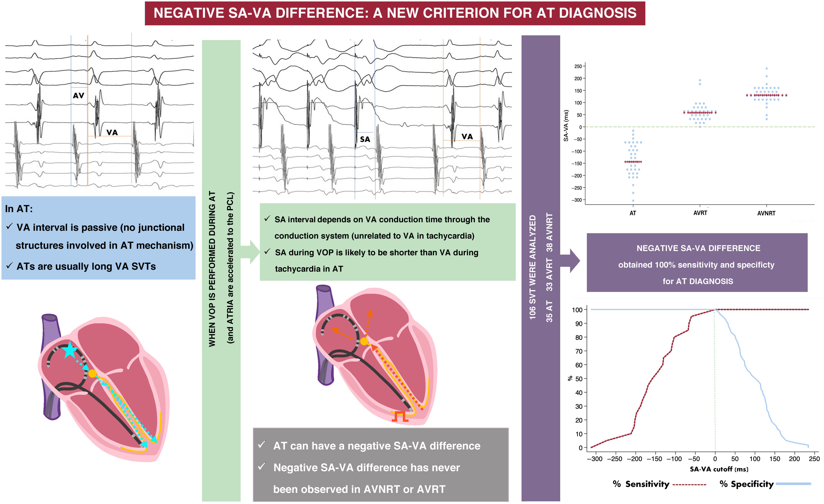 Negative SA-VA difference during ventricular overdrive pacing of  supraventricular tachycardia for the diagnosis of atrial tachycardia -  Revista Española de Cardiología (English Edition)