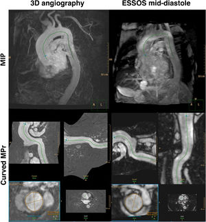 Graphical Abstract ESSOS single breath-hold 3D magnetic resonance for...