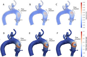 Graphical Abstract Impact of transcatheter aortic valve implantation ...