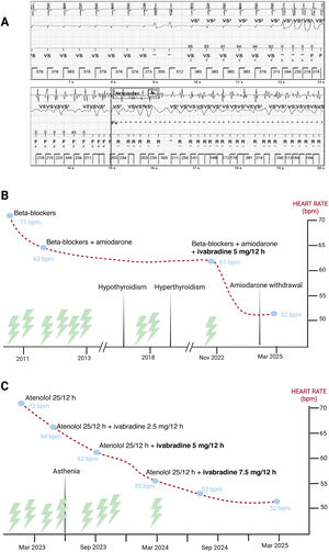 Graphical Abstract Ivabradine for the prevention of sinus tachycardia...