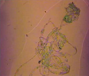 Imagen de microscopia de contraste de un conducto de Bonghan de una arteria de rata. Longitud total ∼4cm42.