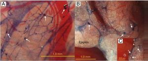 Red de conductos de Bonghan (BHD) reveladas mediante tinción de azul tripán. A) Red de BHD en el peritoneo visceral alrededor del estómago y cerca del bazo de una rata. Varios pequeños BHC en puntos de intersección (flechas). Los capilares sanguíneos no están teñidos. B) Red de BHD en el epiplón entre el estómago y el intestino delgado. Tres pequeños corpúsculos en las intersecciones de los BHD (flechas). C) Recuadro: otra parte del mismo epiplón como en la imagen A; BHD flotando (flecha abierta) conectado con BHD (flechas) en el epiplón, que muestra los BHD como parte de una gran red de BHD libres y móviles en la superficie de los órganos internos.