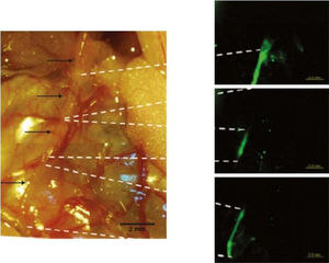 La imagen de la izquierda muestra un conducto de Bonghan (flechas) en un intestino delgado de rata. Las imágenes de la derecha muestran un flujo de nanopartículas tras la inyección en el punto indicado en la línea discontinua superior. Durante los primeros 4min, las nanopartículas se mantuvieron en la primera región; después (tras 12min) se movieron a la mitad y, finalmente, se movieron a la tercera región en 18min. Velocidad de 0,6mm/min en una sola dirección74. La velocidad fue extremadamente lenta debido a las condiciones de temperatura y humedad. El tiempo desde la incisión en el abdomen hasta la inyección de nanopartículas fue de alrededor de 60min. Movimiento peristáltico casi detenido. Con mejores métodos, incluyendo mejores condiciones de viabilidad y lapsos de tiempo más cortos, se logró medir mejor la velocidad del fluido (0,3mm/s)44.