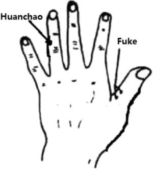 Localización de los acupuntos Tung de la mano.