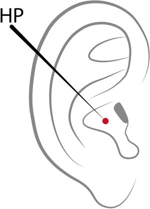 Auricular Heart point.