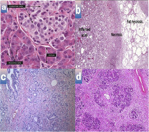 Histopathogical features of a. Control group, b. Tetracycline group, c.Tetracycline+PRP group, d. Tetracycline + acupuncture group. Magnification is 400x.